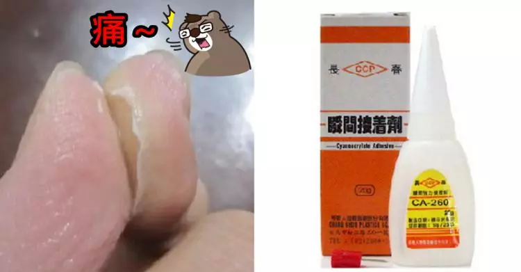三秒膠黏到手該怎麼辦?千萬別再硬撕、刀割...「最正確方法是這樣」!無痛又不留痕跡