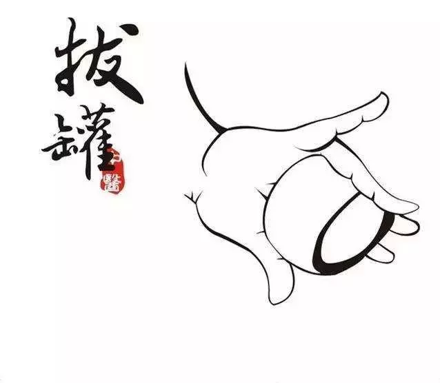 拔罐的好處那麼多還要注意哪些
