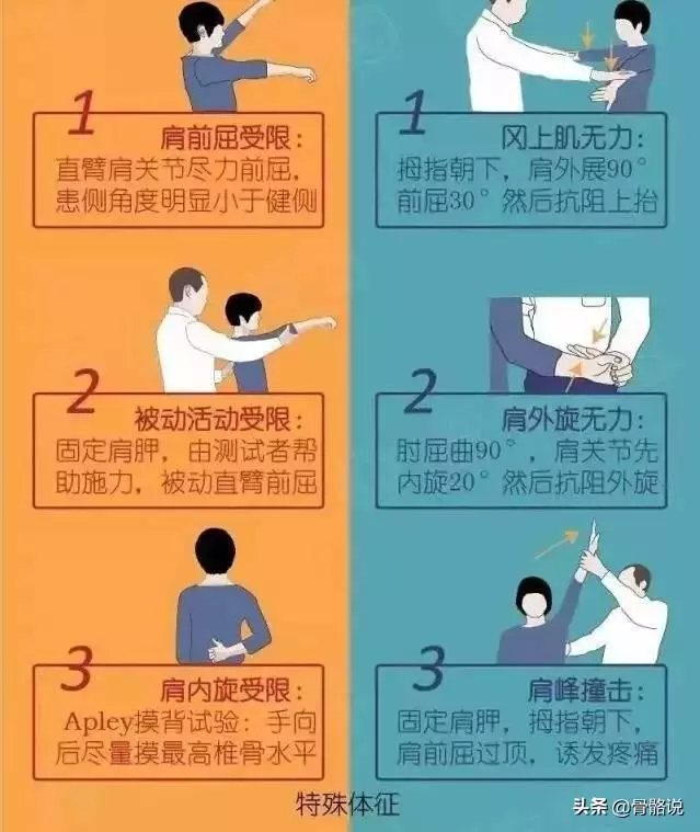 4個動作天天練,告別肩周炎不再犯