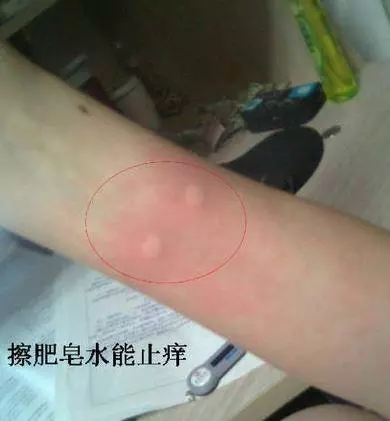 除蟑螂秘方:只用一顆馬鈴薯,就把家中蟑螂通通消滅,解決一大片,太厲害了