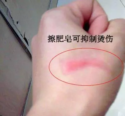 除蟑螂秘方:只用一顆馬鈴薯,就把家中蟑螂通通消滅,解決一大片,太厲害了
