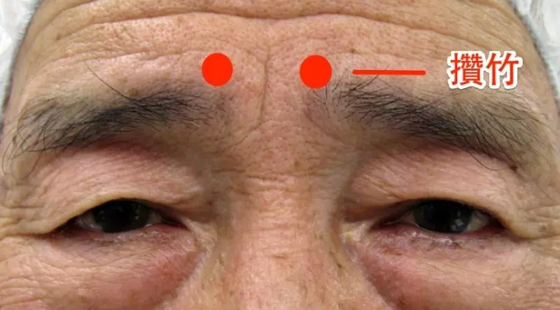 神奇的一分鐘治療法,對不起各位醫生了啊!