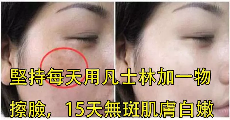 沒想到,堅持每天用「凡士林」加一物擦臉,15天還你無斑白嫩肌膚!