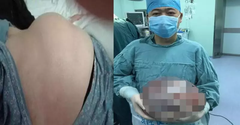 她未婚也無男友肚子卻大得出奇,到醫院檢查後醫生緊急幫她開刀,竟然在她肚子裡挖出了........太恐怖了!!