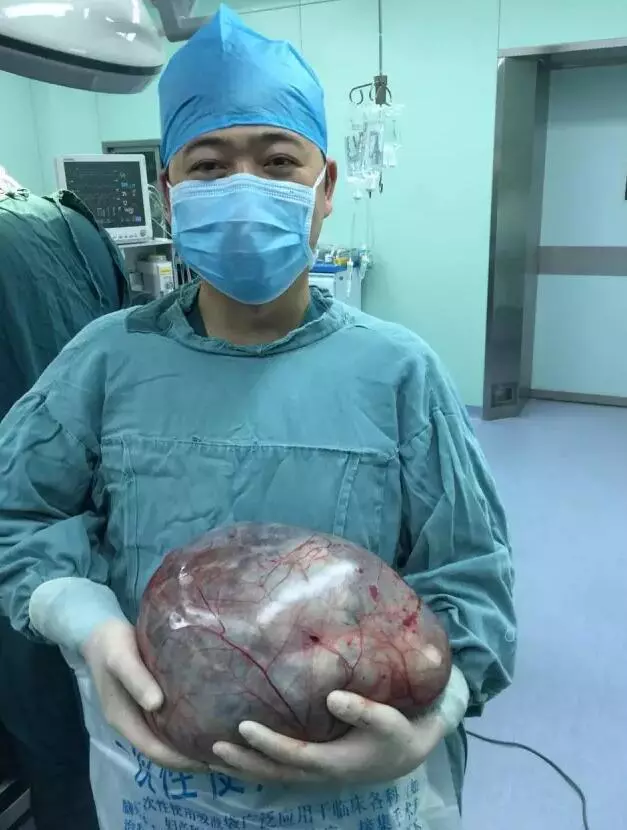 她未婚也無男友肚子卻大得出奇,到醫院檢查後醫生緊急幫她開刀,竟然在她肚子裡挖出了........太恐怖了!!