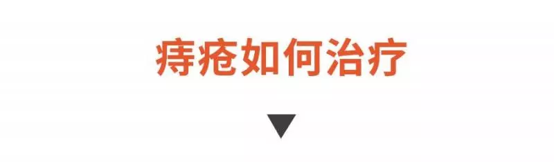 十人九痔,不能忽視!4個妙方,幫你跟痔瘡說再見,遠離痛苦