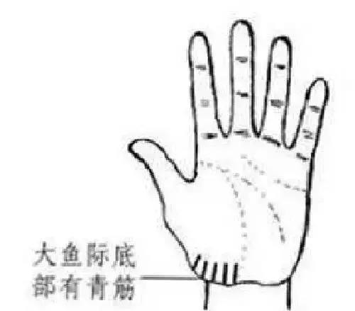 手相看健康狀況圖解!收了吧!