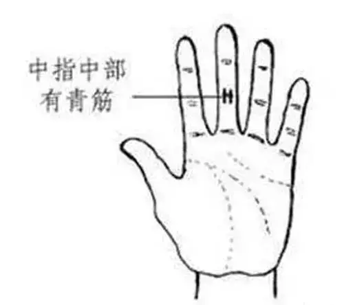 手相看健康狀況圖解!收了吧!
