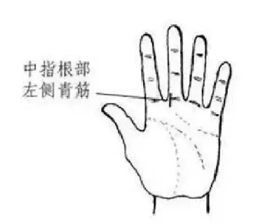 手相看健康狀況圖解!收了吧!