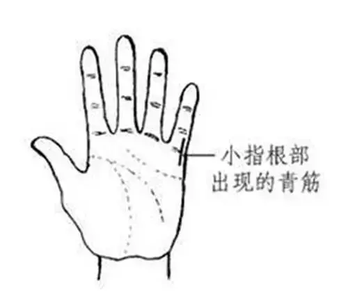 手相看健康狀況圖解!收了吧!