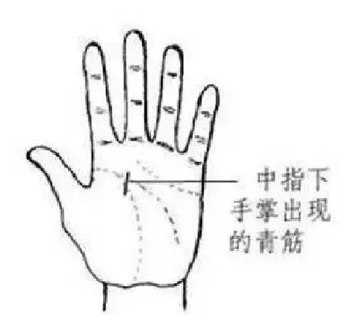 手相看健康狀況圖解!收了吧!