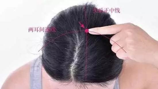 頭髮少怎麼辦?每天花5分鐘按按這些「生髮穴」