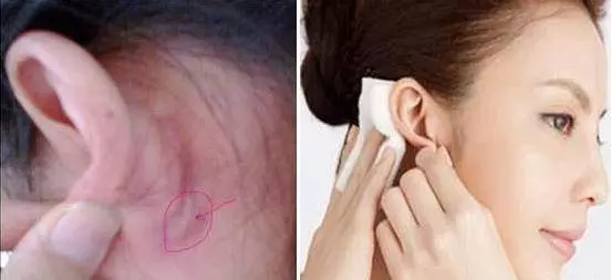 每天按「耳後窩」10秒鐘,巧妙地控制血糖,有利於血糖平穩,分泌胰島素,糖尿病患者多做有益