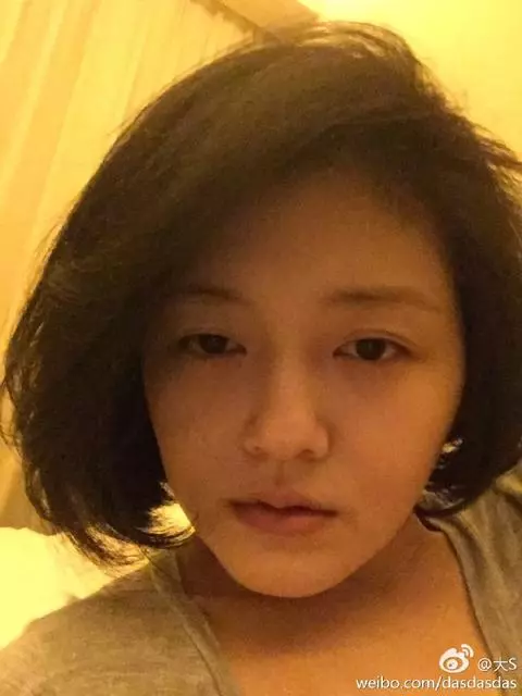 大S爆肥腫出新高度被狂酸「撞臉婆婆張蘭」!她委屈反駁「有點腫但....」如今竟變這樣!