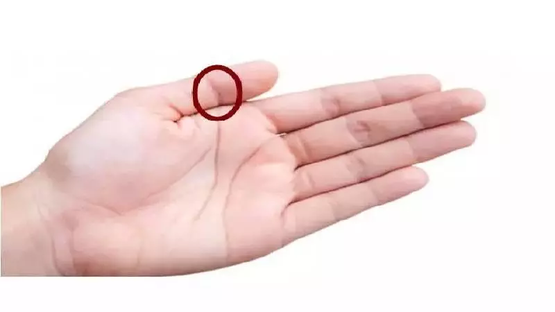 左手拇指上有佛眼的女人,不簡單!看看你有嗎?