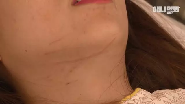 「陪睡抓傷主人」好失控!「睡著就變惡魔」醫生嘆:牠有陰影...