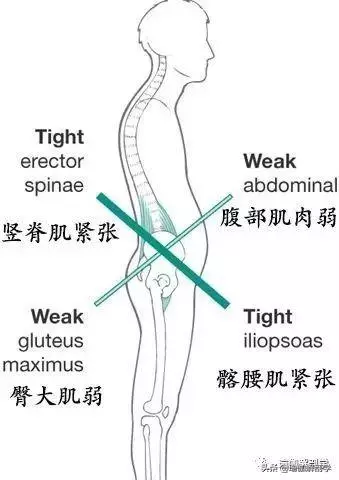 腰肌勞損,腹部無力?這6個經典的動作要常練!(附動圖)