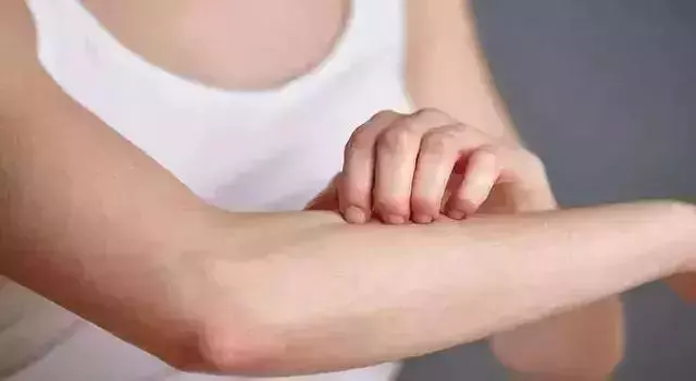 艾灸後為什麼會癢?艾灸後會癢,是好現象嗎