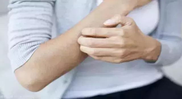 艾灸後為什麼會癢?艾灸後會癢,是好現象嗎