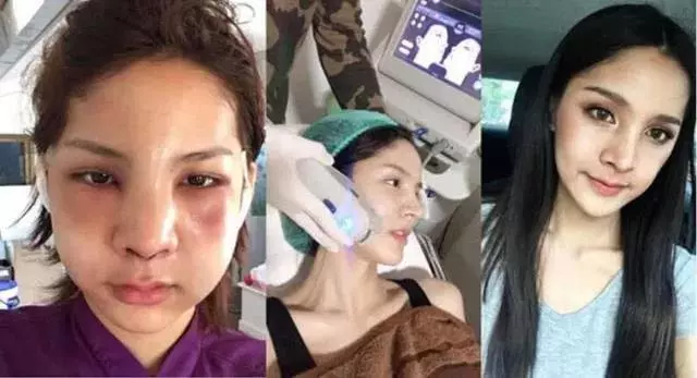 帥小伙不惜變性成辣妹 只為逃避服兵役……這波操作真是讓人瞠目結舌