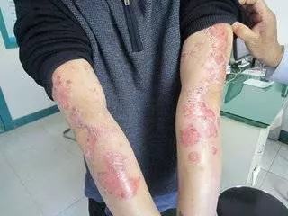 過了40歲,體內這9種毒,不除很難長壽!排出陰毒,健康少病,延年益壽!