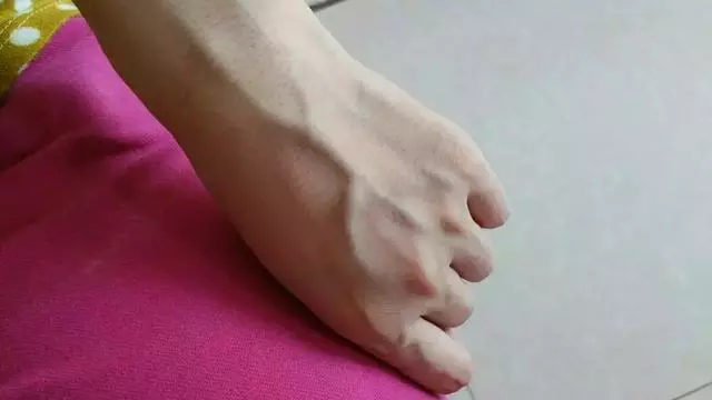 養好肝，是養生的根本！肝臟好的人手上通常有4個「標誌」