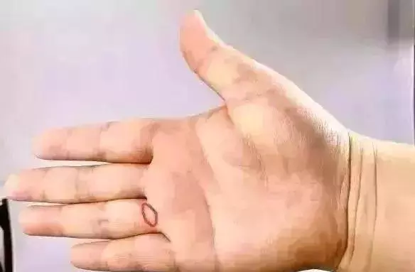 一個奇穴,專治各種「不通」!每天捏捏手指,防治7大疾病