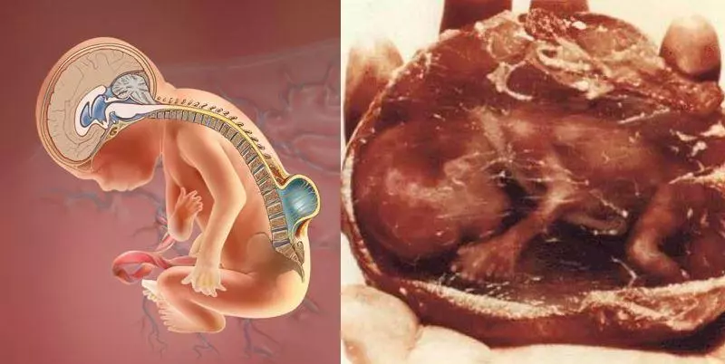 妳知道墮胎後嬰靈究竟去哪裡了嗎?(看完真的很難過…轉發給更多人知道!)