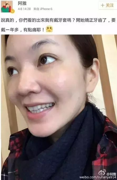 那些默默變美的明星們不是整容,原來全靠這一招!