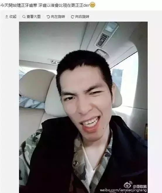 那些默默變美的明星們不是整容,原來全靠這一招!