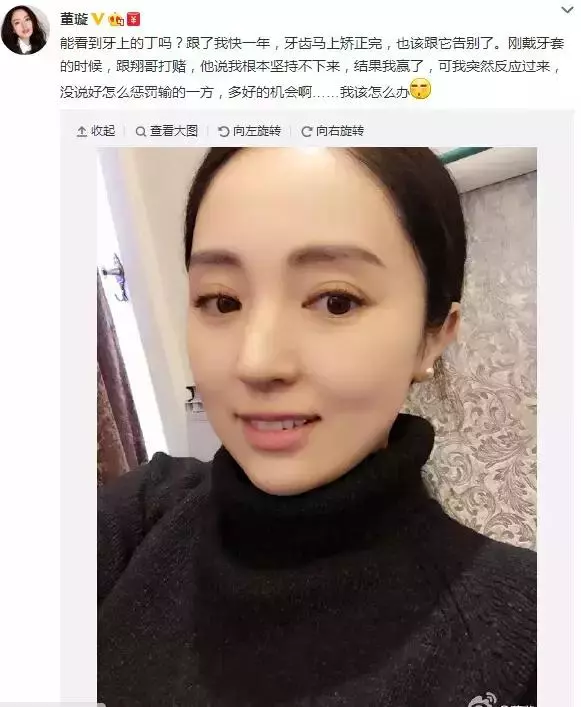 那些默默變美的明星們不是整容,原來全靠這一招!
