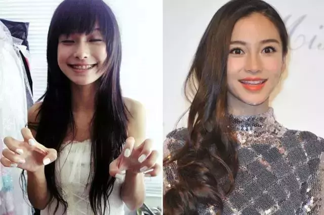 那些默默變美的明星們不是整容,原來全靠這一招!