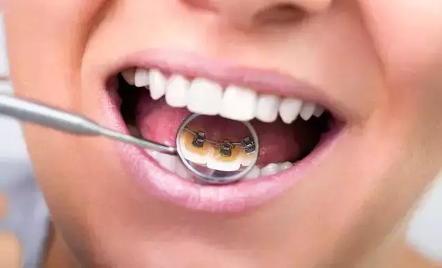 那些默默變美的明星們不是整容,原來全靠這一招!