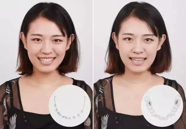 那些默默變美的明星們不是整容,原來全靠這一招!