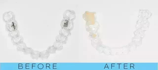 那些默默變美的明星們不是整容,原來全靠這一招!