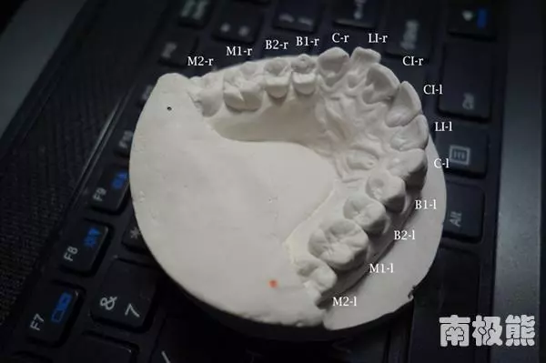 他自己做「牙套」只花了不到2000元,結果讓人贊賞...「這招」外流的話牙醫診所都要哭了!