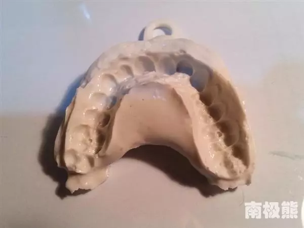 他自己做「牙套」只花了不到2000元,結果讓人贊賞...「這招」外流的話牙醫診所都要哭了!