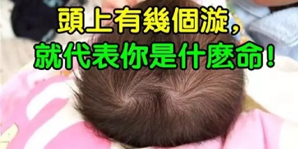頭上有幾個漩,就代表你是什麼命!有三個漩的人註定不一般,太準了!