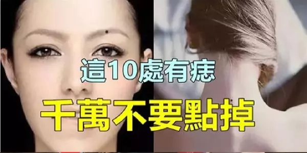 身上這10處有痣的人,太幸運了,真是恭喜你們,不管早晚,今生註定發達