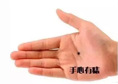 身上這10處有痣的人,太幸運了,真是恭喜你們,不管早晚,今生註定發達