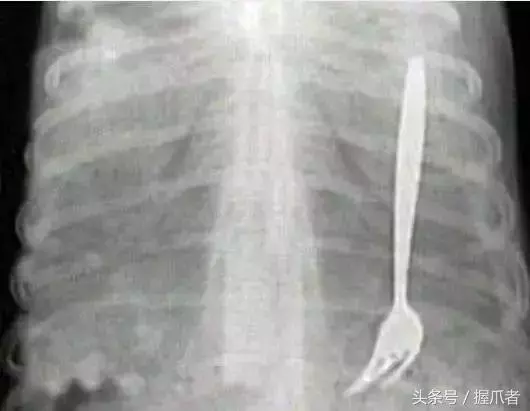 二哈不吃不喝,主人以為得絕症了,結果把醫生笑慘了