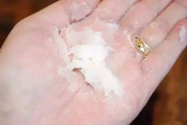 天氣一冷手就變得皺巴巴的?教你一個土方法,讓雙手變的嫩又滑!