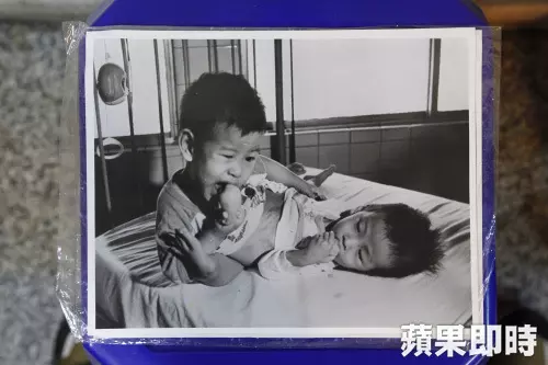 又一位名人過世!台灣首對「連體嬰」42歲哥哥驟逝,慘被爸媽拋棄,過世了也「無法被捧斗回家」!