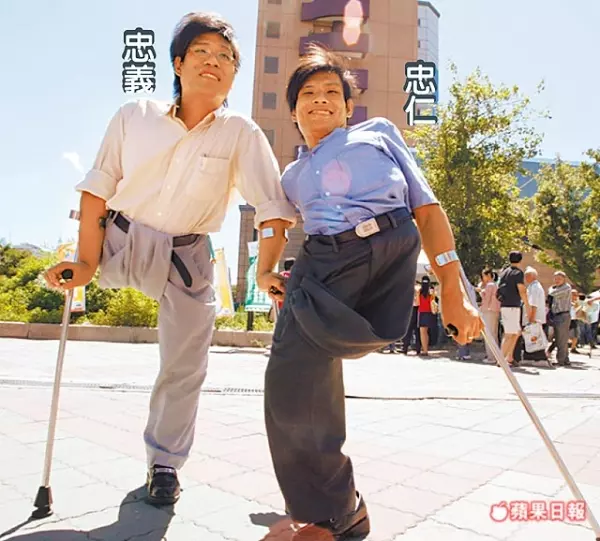 又一位名人過世!台灣首對「連體嬰」42歲哥哥驟逝,慘被爸媽拋棄,過世了也「無法被捧斗回家」!