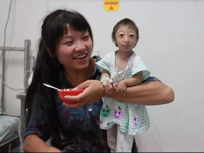 現實中的《拇指姑娘》3歲半,直擊她的日常生活,媽媽「呵護備至」不敢放鬆,網友淚崩:【最偉大的愛】