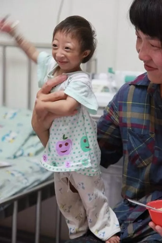 現實中的《拇指姑娘》3歲半,直擊她的日常生活,媽媽「呵護備至」不敢放鬆,網友淚崩:【最偉大的愛】