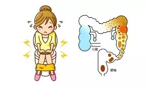 女子便秘1周送醫,醫生用尿管插肛 下秒「糞水炸出」醫生:這下完了...