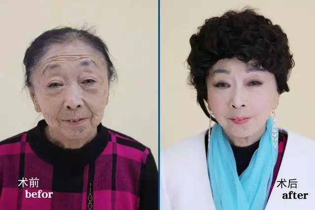 為了嫁給37歲年輕帥哥,71歲老婆婆傾家蕩產「整成年輕少婦」,前後變化太大了.....