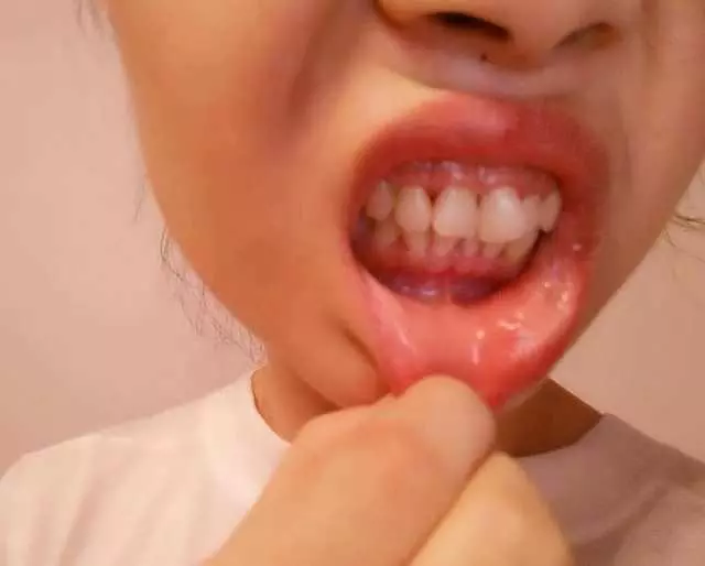 要預防肝臟受損,這「3種食物」千萬不能吃,吃一次,對肝臟的傷害就多一次