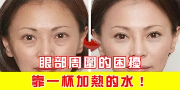 眼部周圍的困擾,就靠一杯加熱的水!